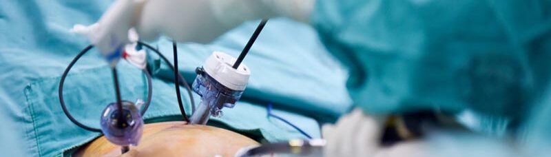 Cirurgias Minimamente Invasivas em Ginecologia