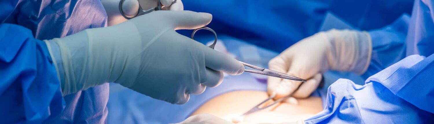 Cirurgias Minimamente Invasivas em Ginecologia